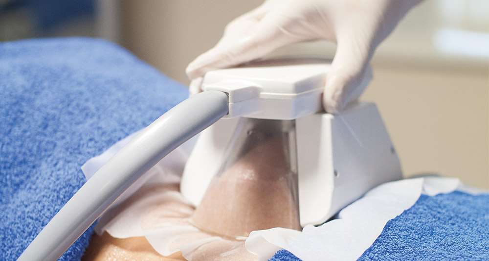 How Fat Freezing and HIFU Work Together? 2 Multiple Areas in One Session HIFU and Fat Freezing Ferndown